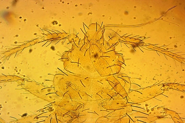 Голова личинки клопа под микроскопом